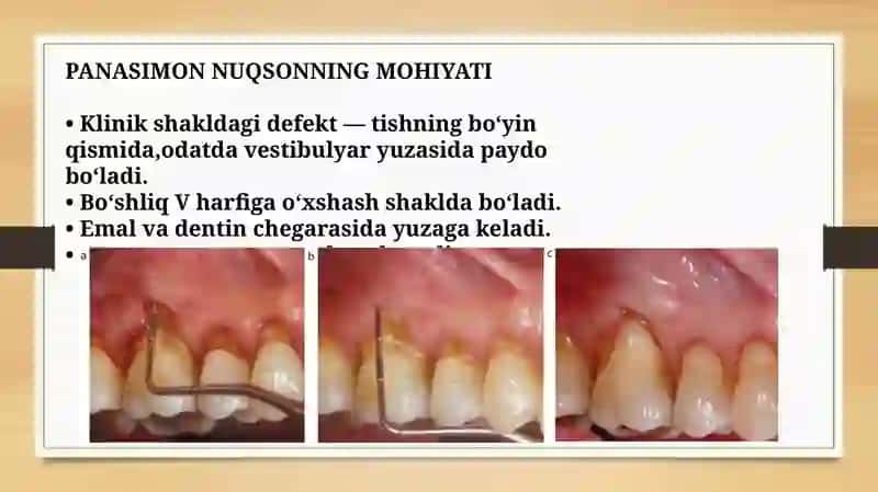 Ponasimon nuqson: Etiologiyasi va klinikasi. 3