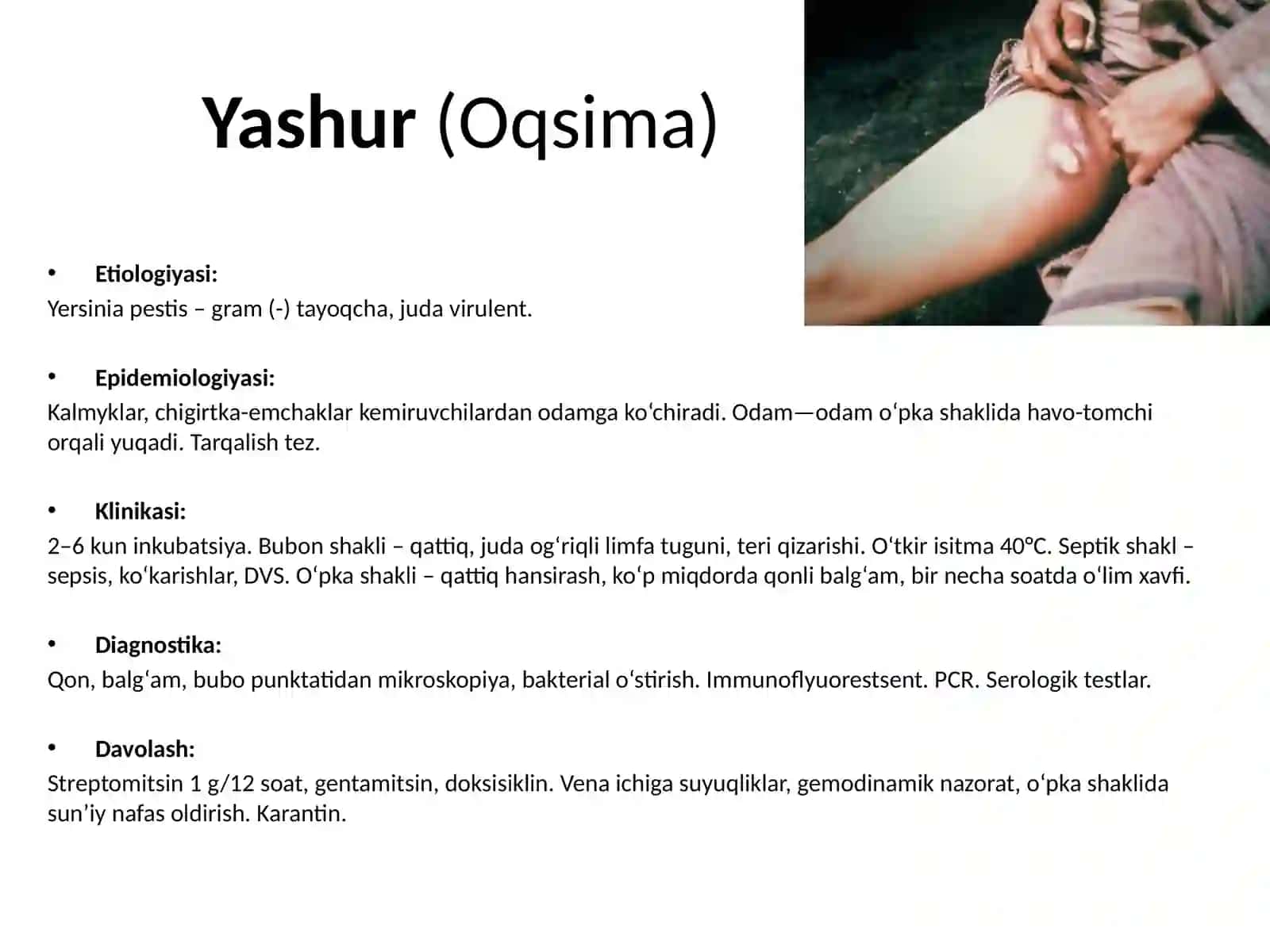 O‘ta hafli infeksiyalar 3