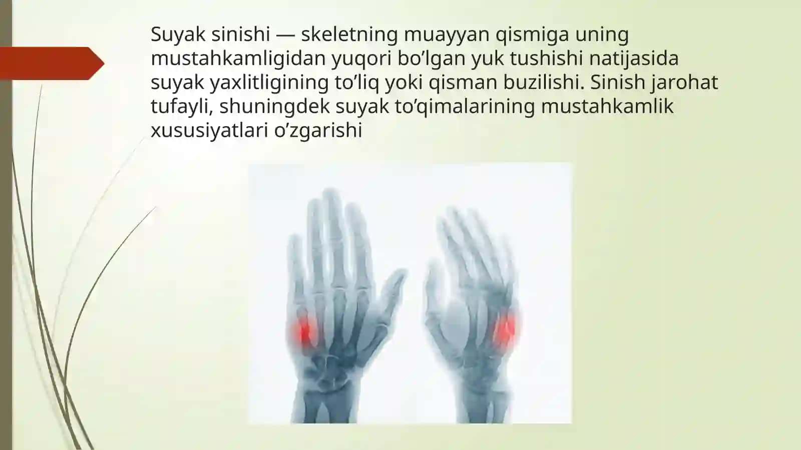 Suyak Sinishi 3