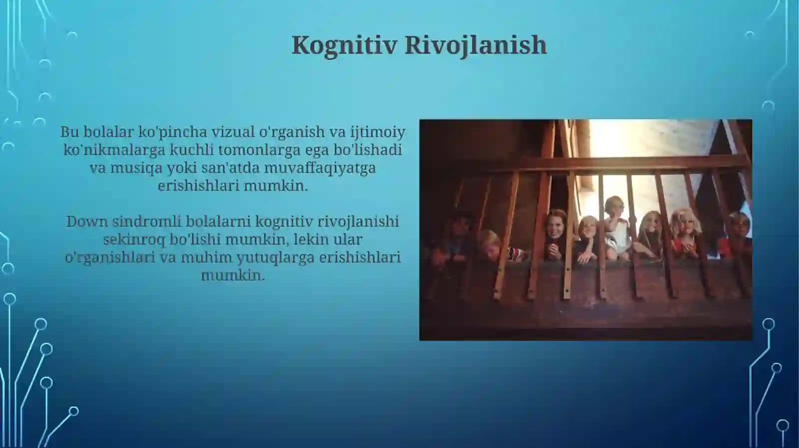 Daunsindiromlibolalarningxususiyati 3