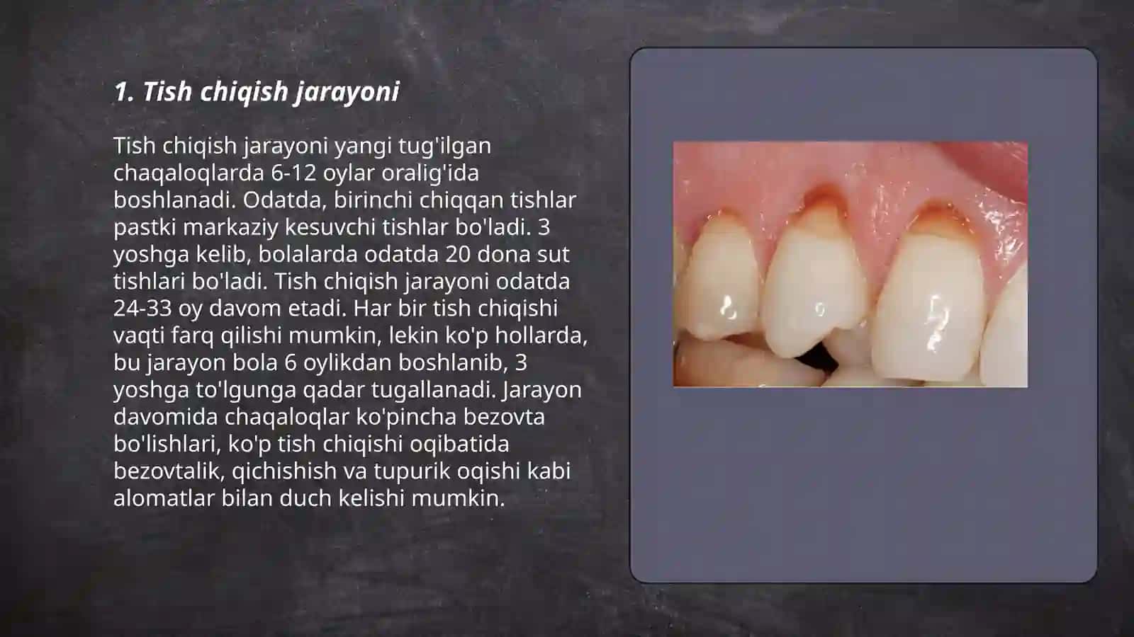 Tish chiqish jarayoni 3
