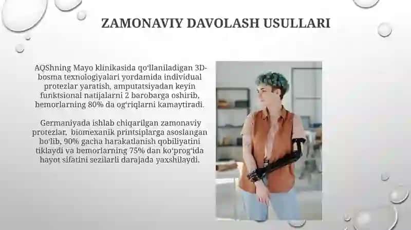 Amputatsiya hususiyatlari 3