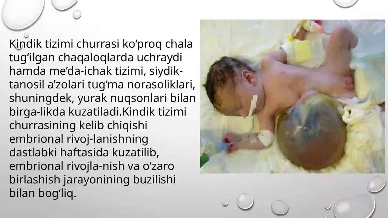 EMBRIONAL CHURRA(KINDIK TIZIMCHASI CHURRASI) 3