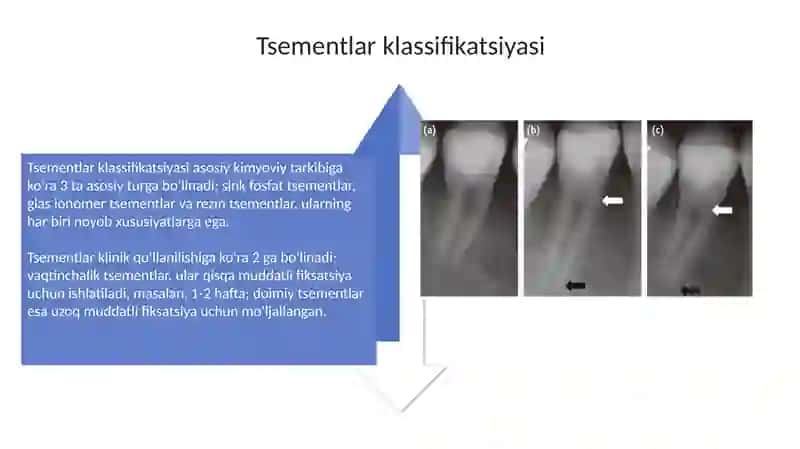 Tishvasementlar 4