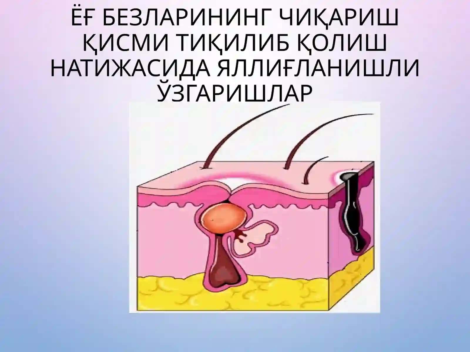 Хусунбузар 4