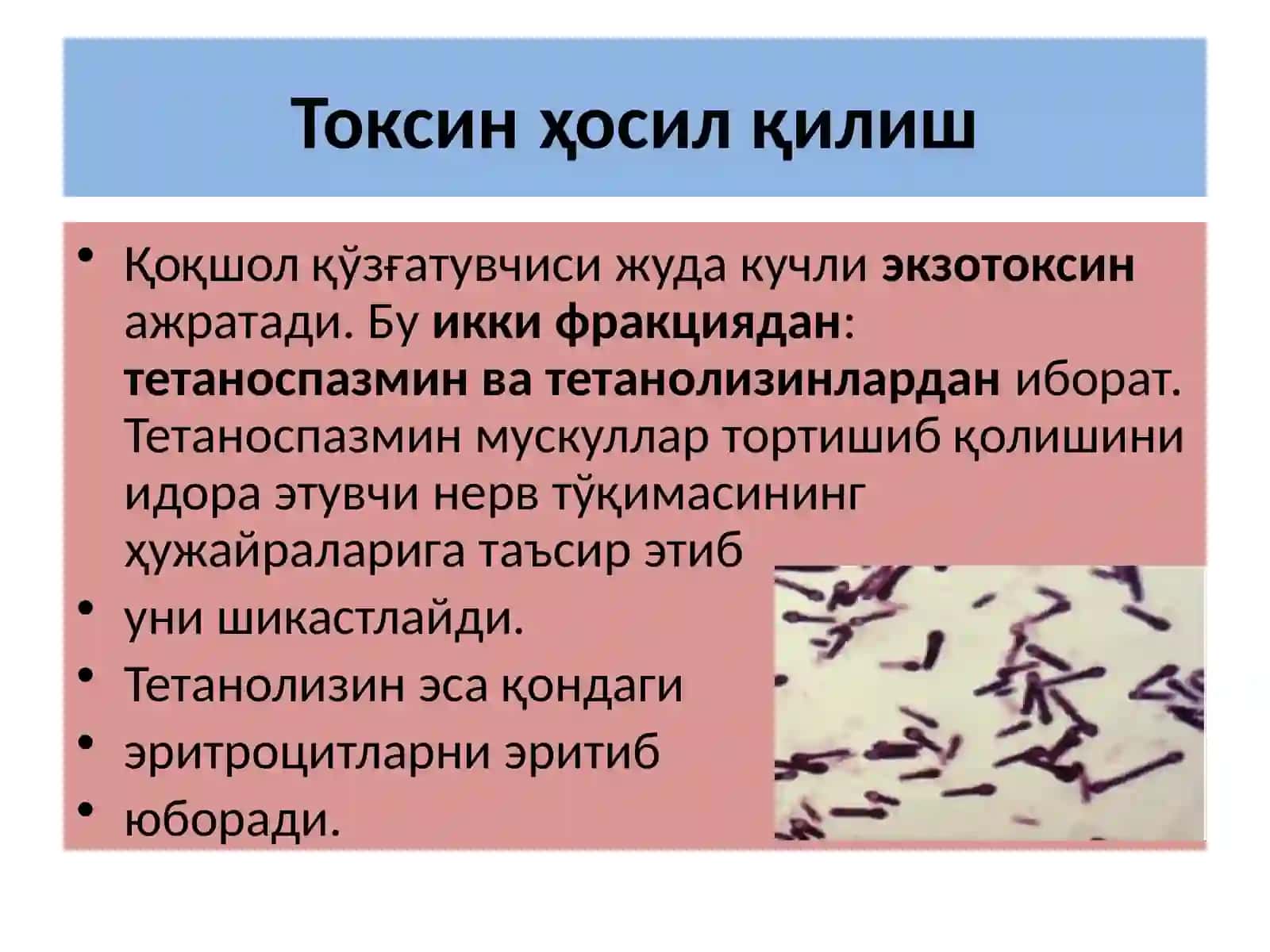 Қоқшолқўзғатувчиси 4