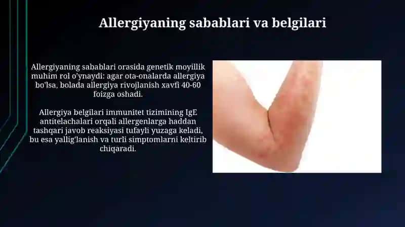 Allergiya: Ta'rif va turlari 4