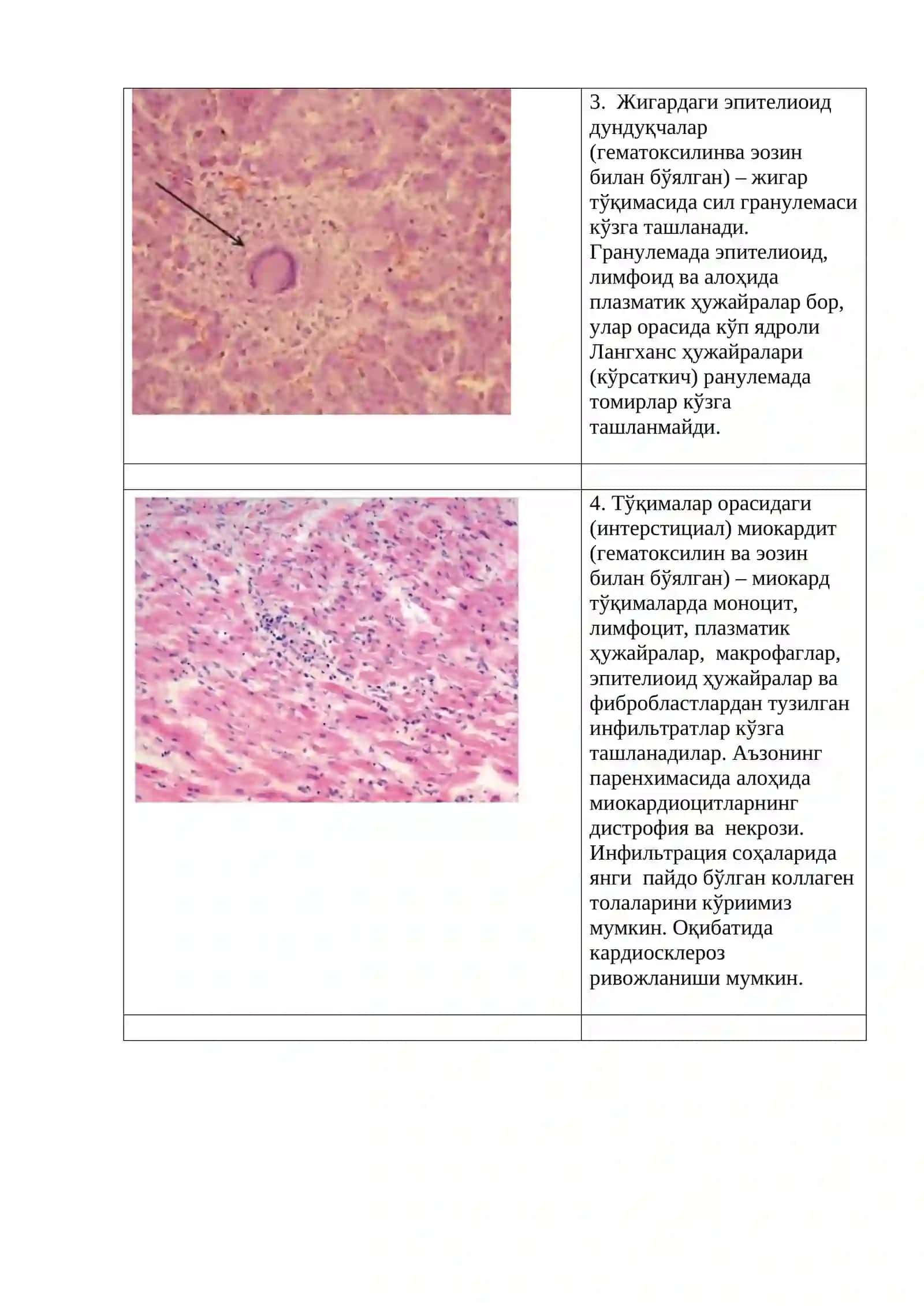 Продуктив яллиғланиш 4