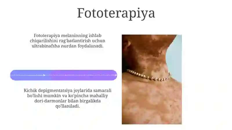 Vitiligoning zamonaviy davolash usullari 4