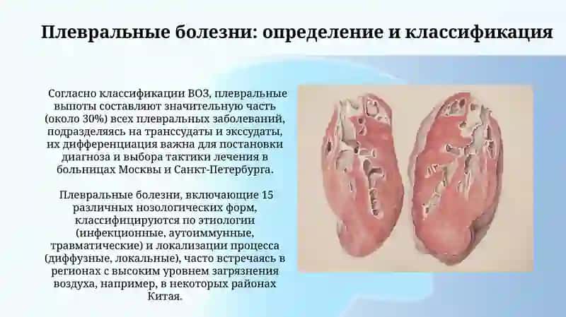 Прионные заболевания. Заболевания плевры 4