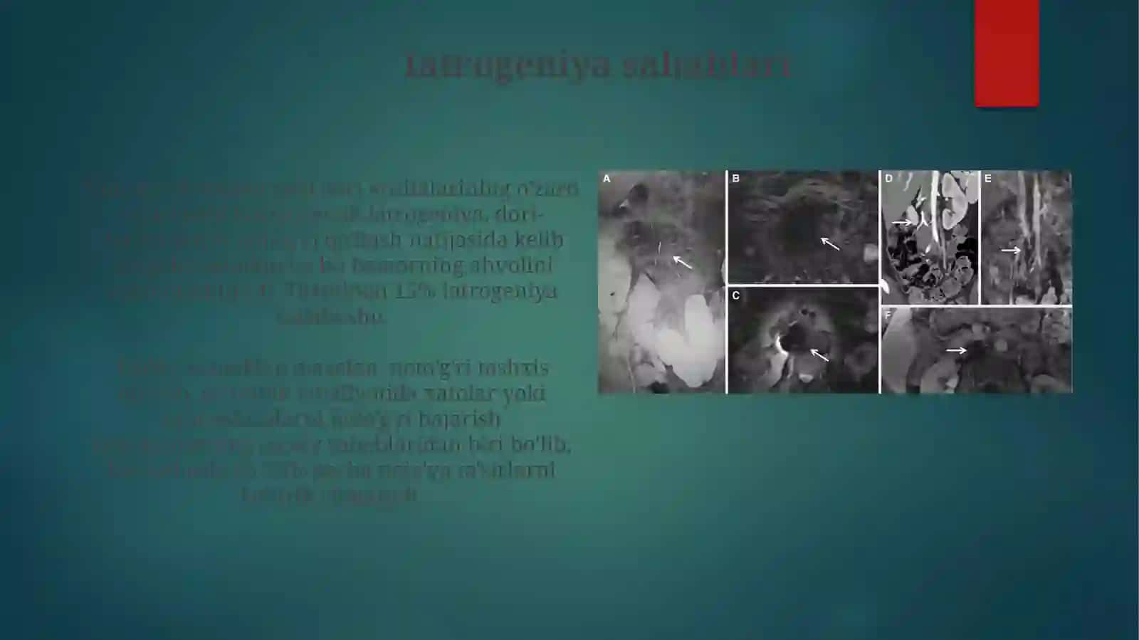 Iatrogeniya: Ta'rif, Sabablari va Turlari 4