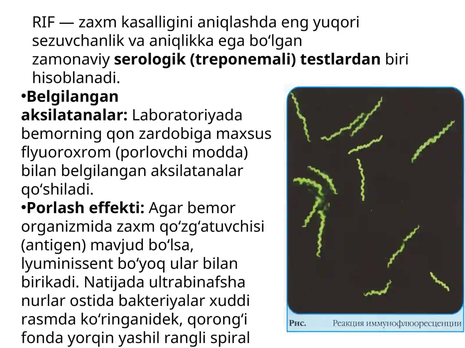 zaxm 4
