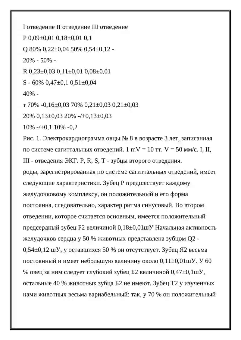 Электрокардиография 4