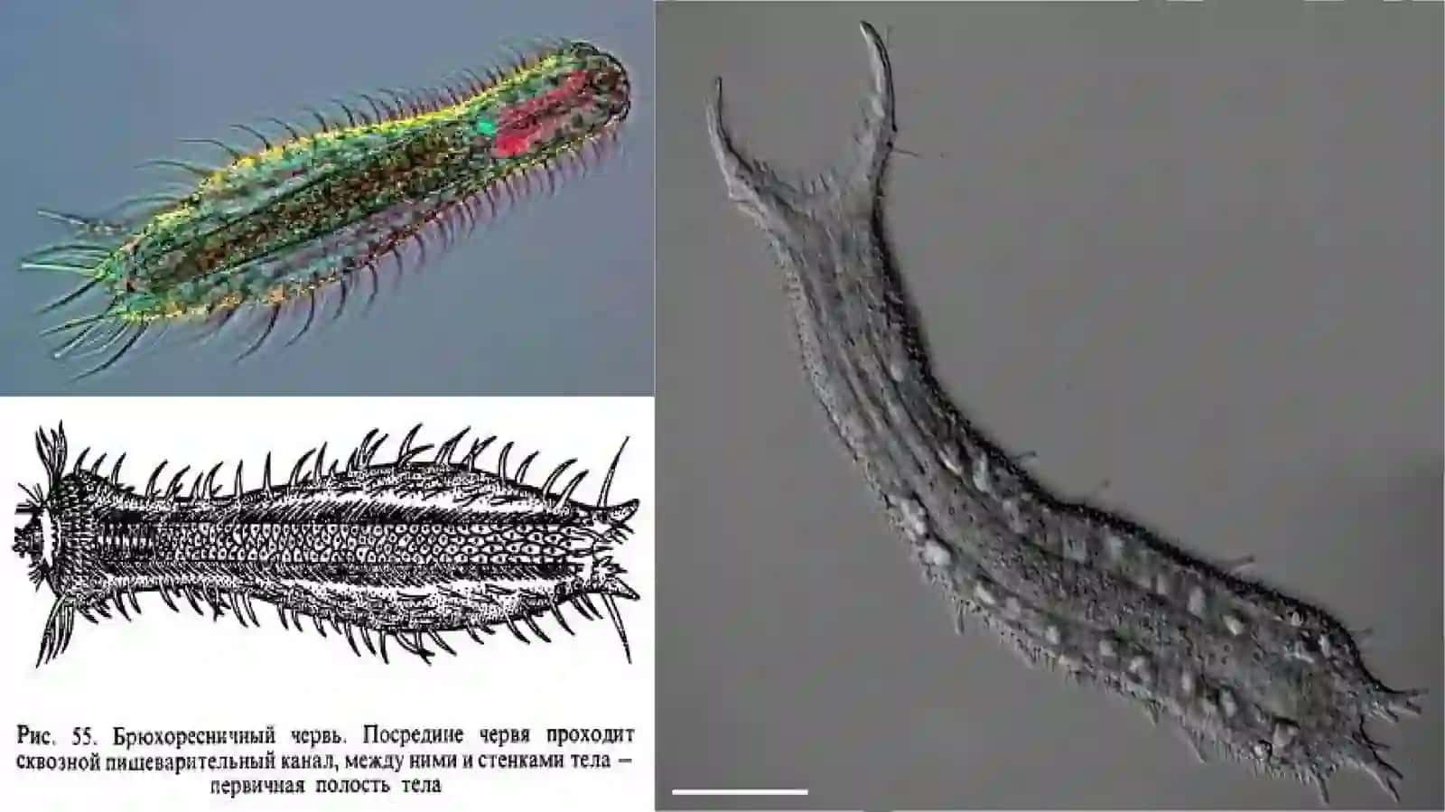 Qorin kiprikli chuvalchanglar (Gastrotricha) 4