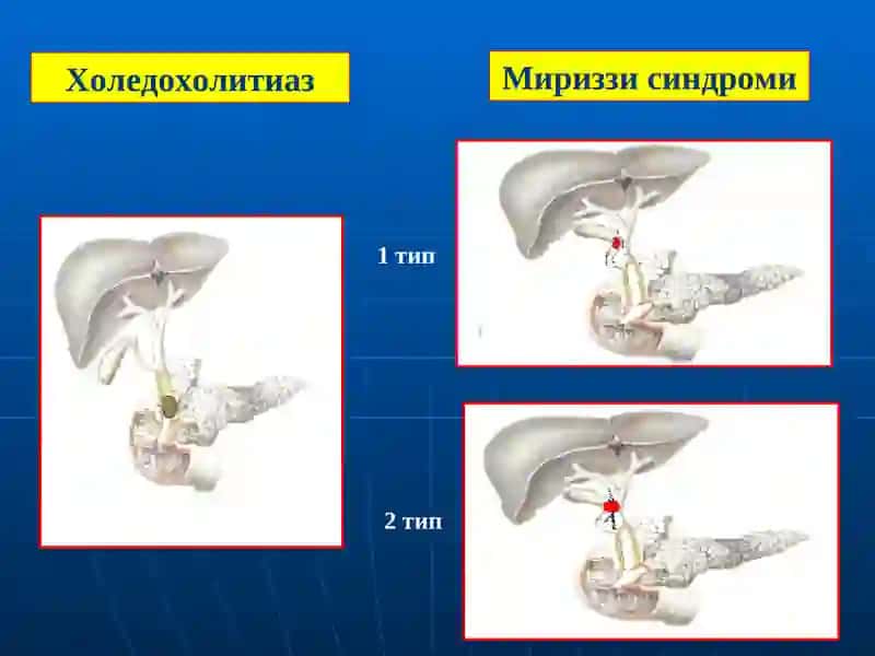 Mexanik sariqlik | Механик сариқлик 4