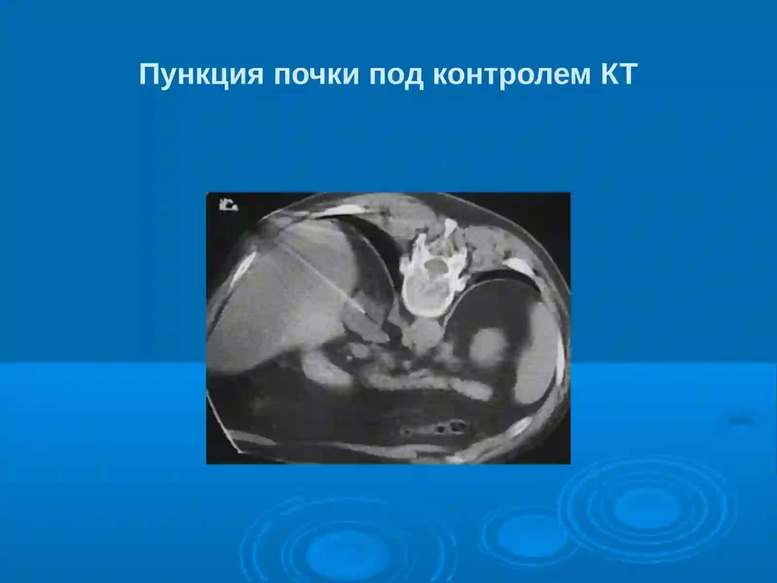 Эндоскопическая урология. Инструментальная урология 4