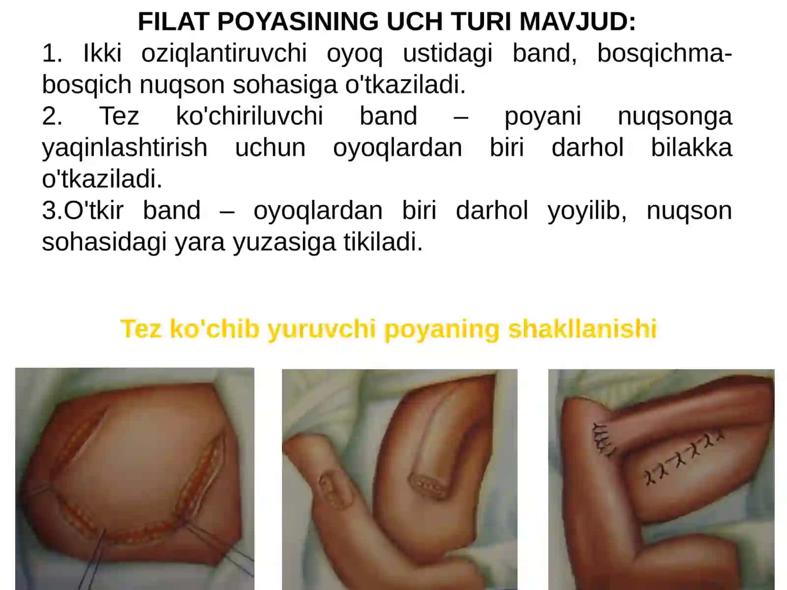 Filatov bandi bilan plastika 4