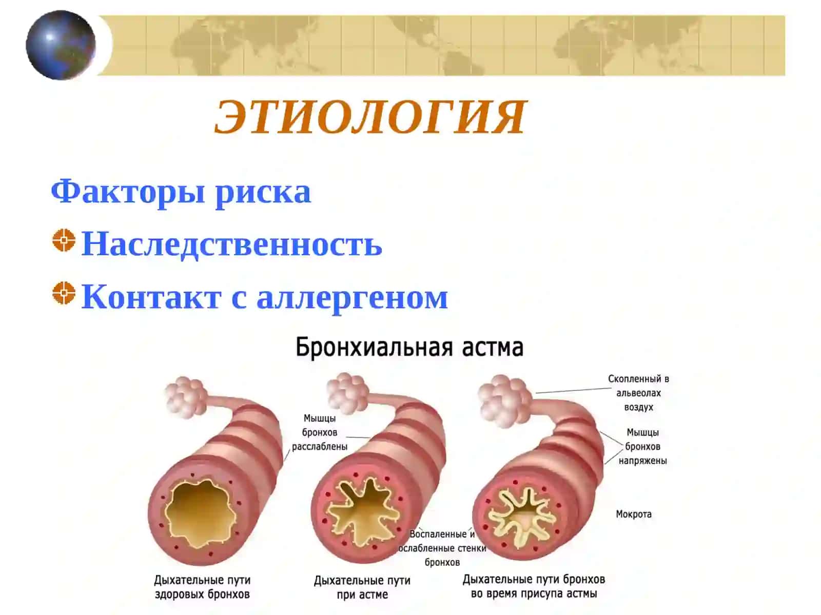 БРОНХИАЛЬНАЯ АСТМА 4