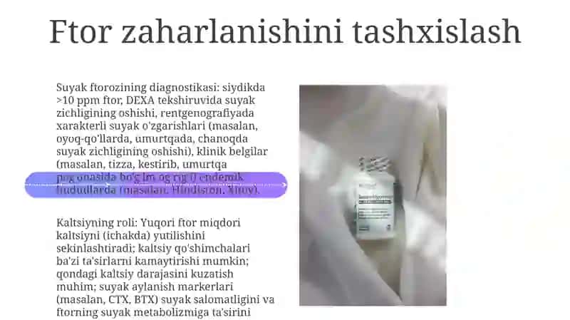 Ortiqcha ftor va kaltsiyning sog'liqqa ta'siri 4