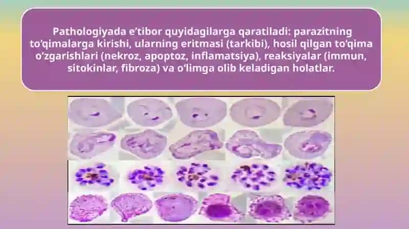 Parazitar infeksiyalar(malyariya,leyshmanioz, amebiaz) 4