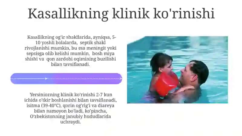 Yersinina kasaligi 4