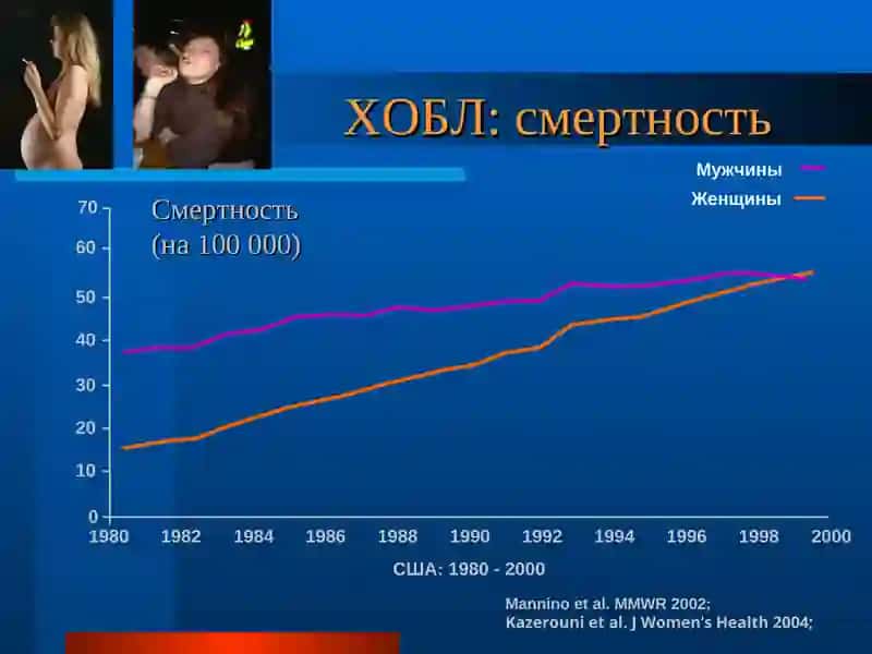 СОУК ( Сурункали обструктив упка касаллиги) 4