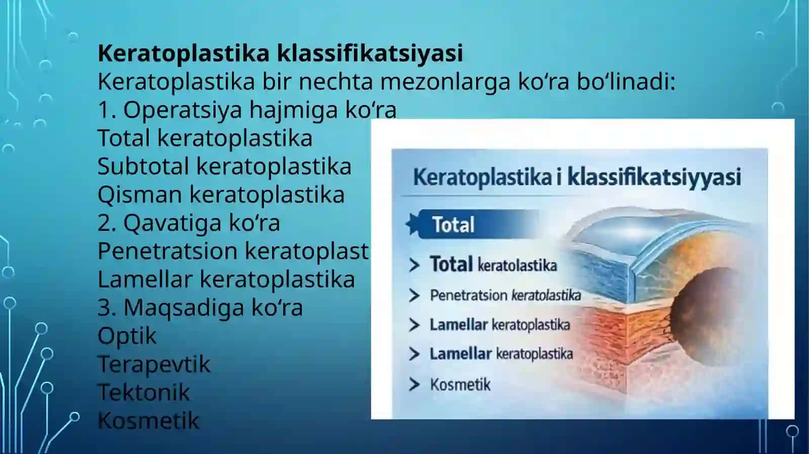 Keratoplastika, uning turlari va asoratlari 4