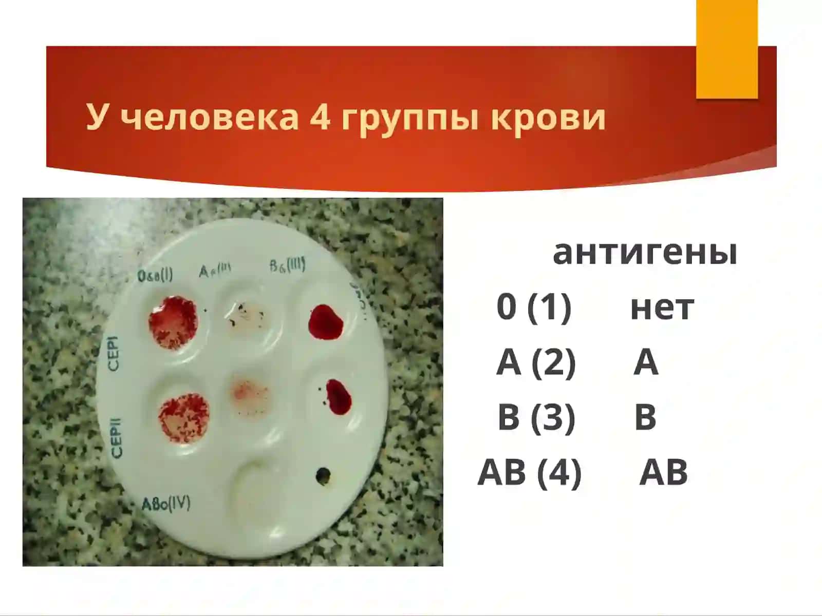 ГРУППЫ КРОВИ 4