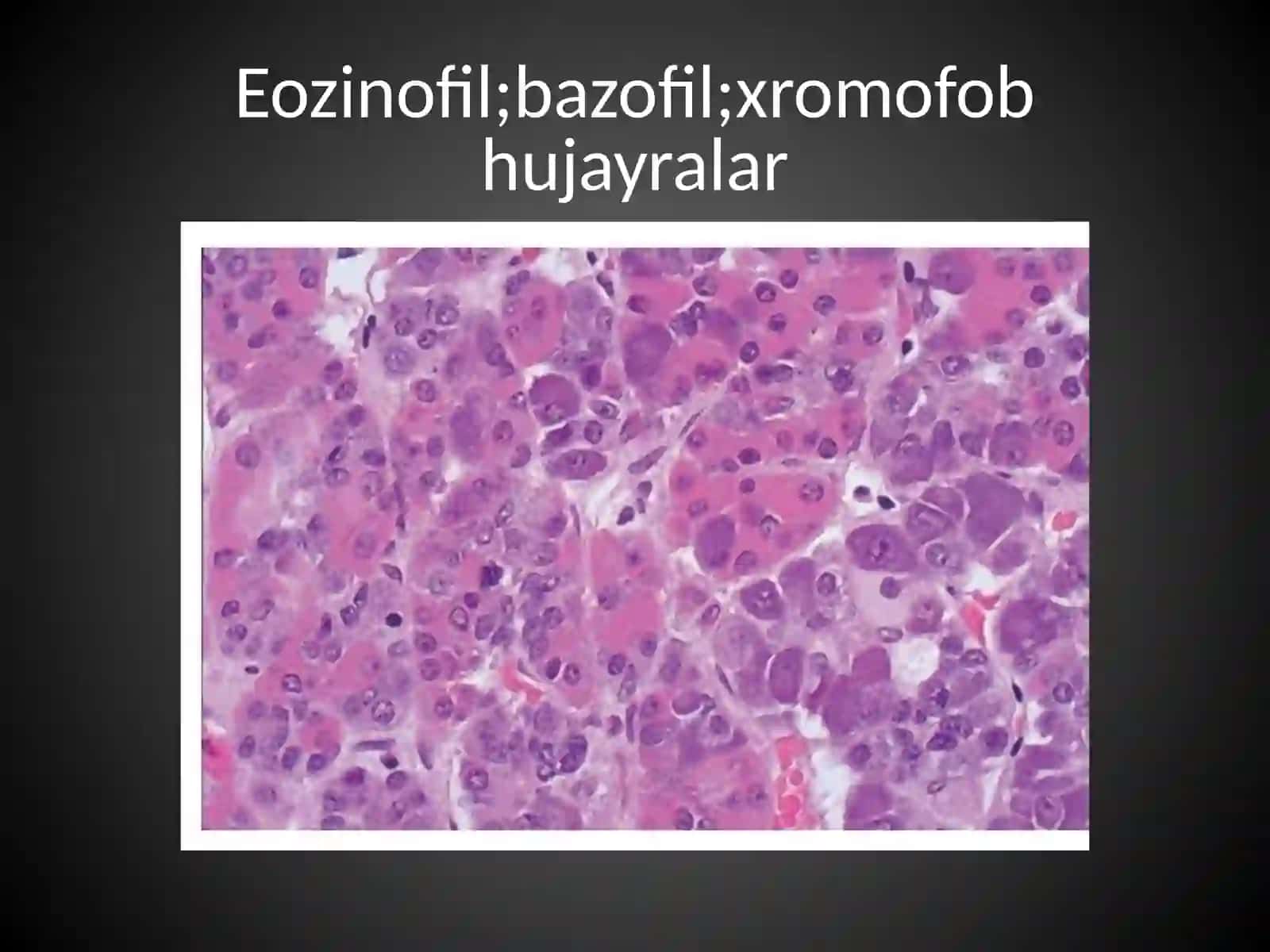 Endokrin bez kasalliklari 4