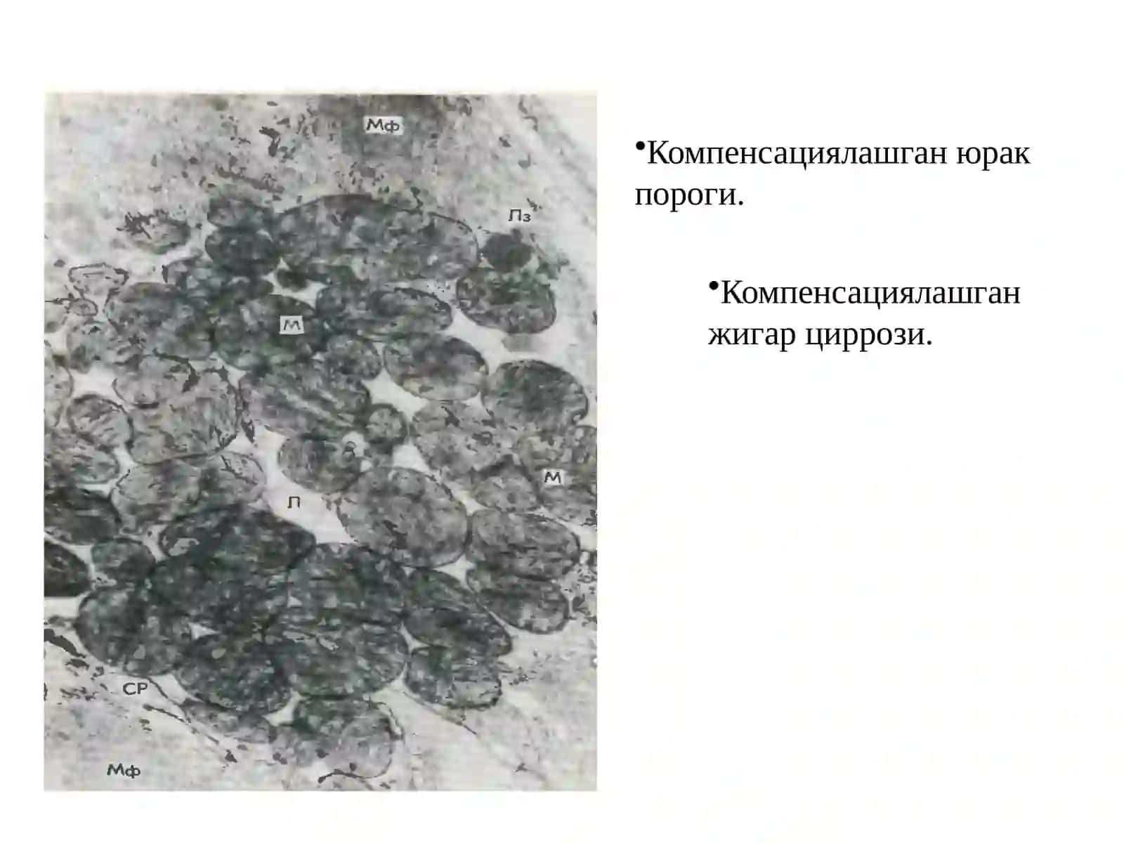КОМПЕНСАТОР – МОСЛАНИШ ЖАРАЁНЛАРИ 4