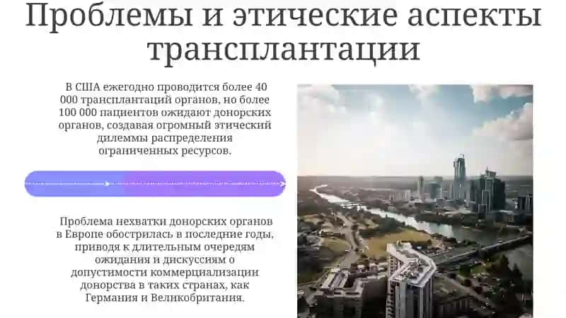 Развитие трансплантации на современном етапе 4
