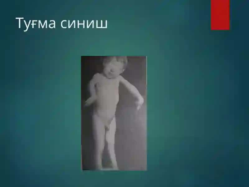 Суякларнинг синиши ва чикиши 4