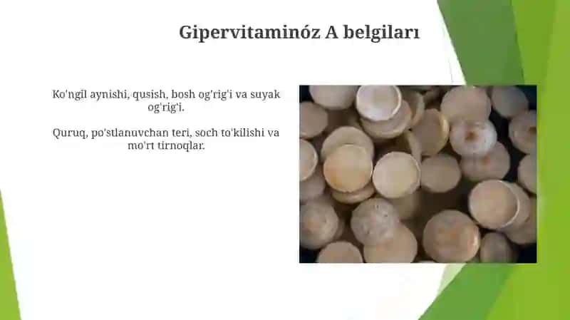 Giper vitaminozi va A vitaminozi haqida 4