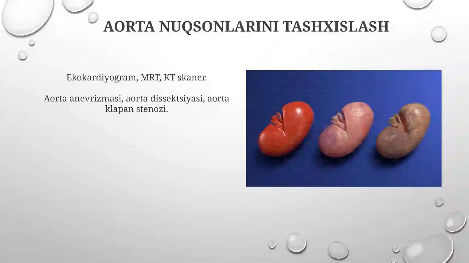 Aortalnuqsonlarsimptomatologiyasi 4