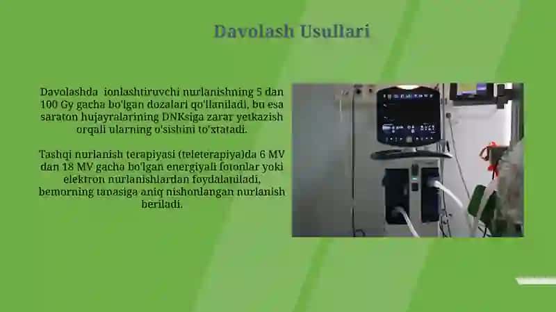 Ionlashtiruvchi nurlanishdan davolashda foydalanish 4