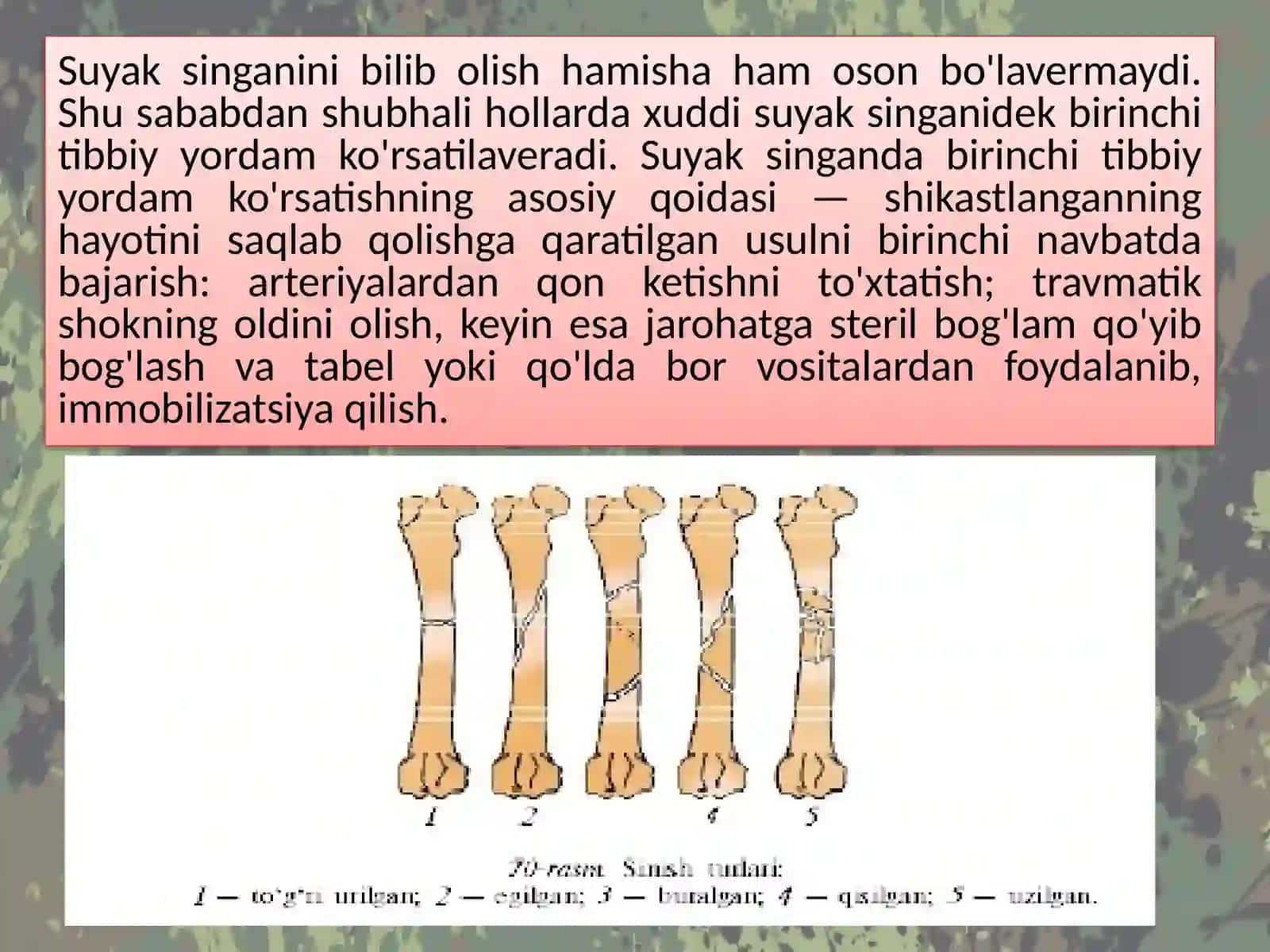 Suyak sinishining tushunchalari 4