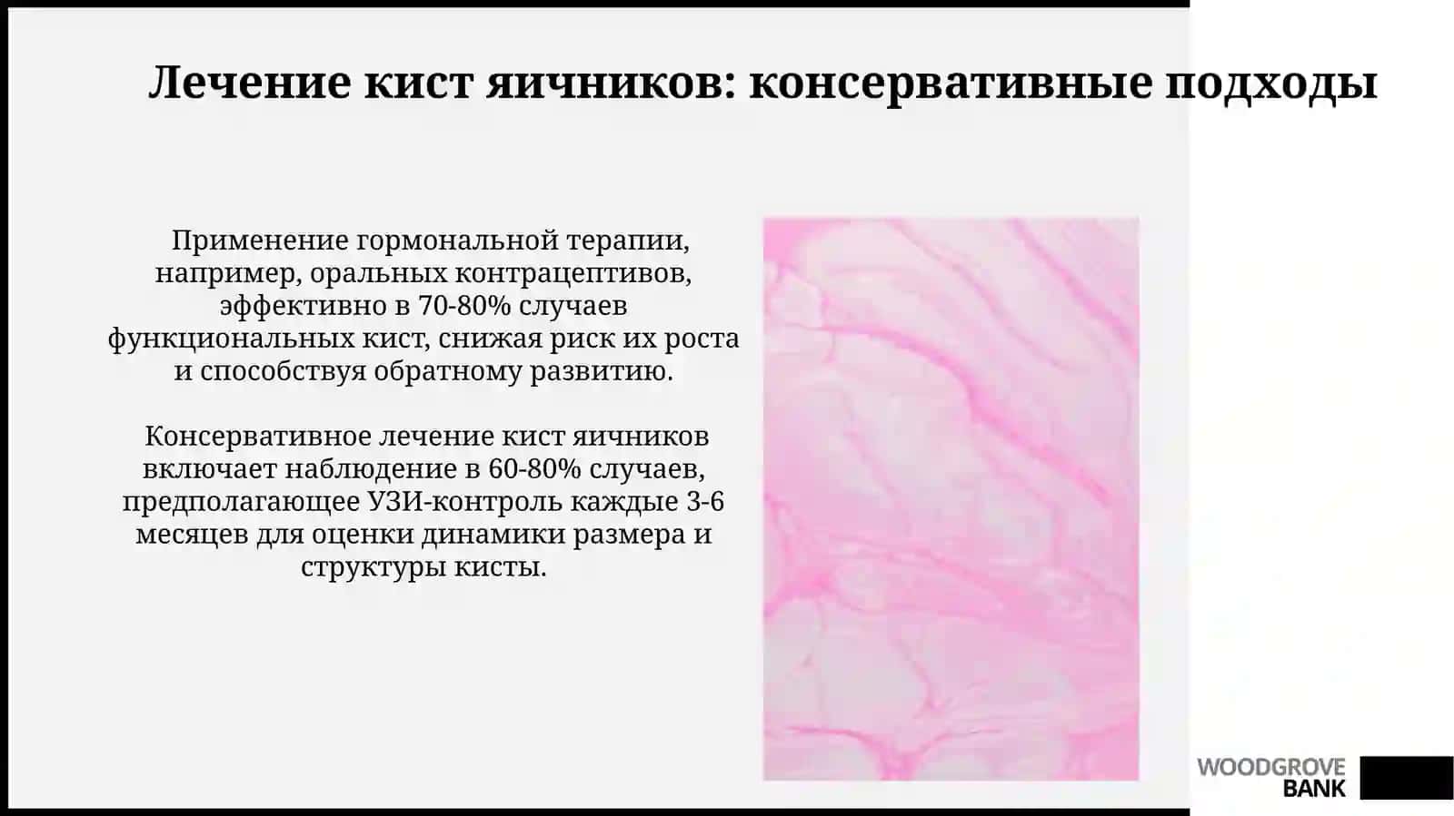 Создание практического руководства по кистам яичников 4