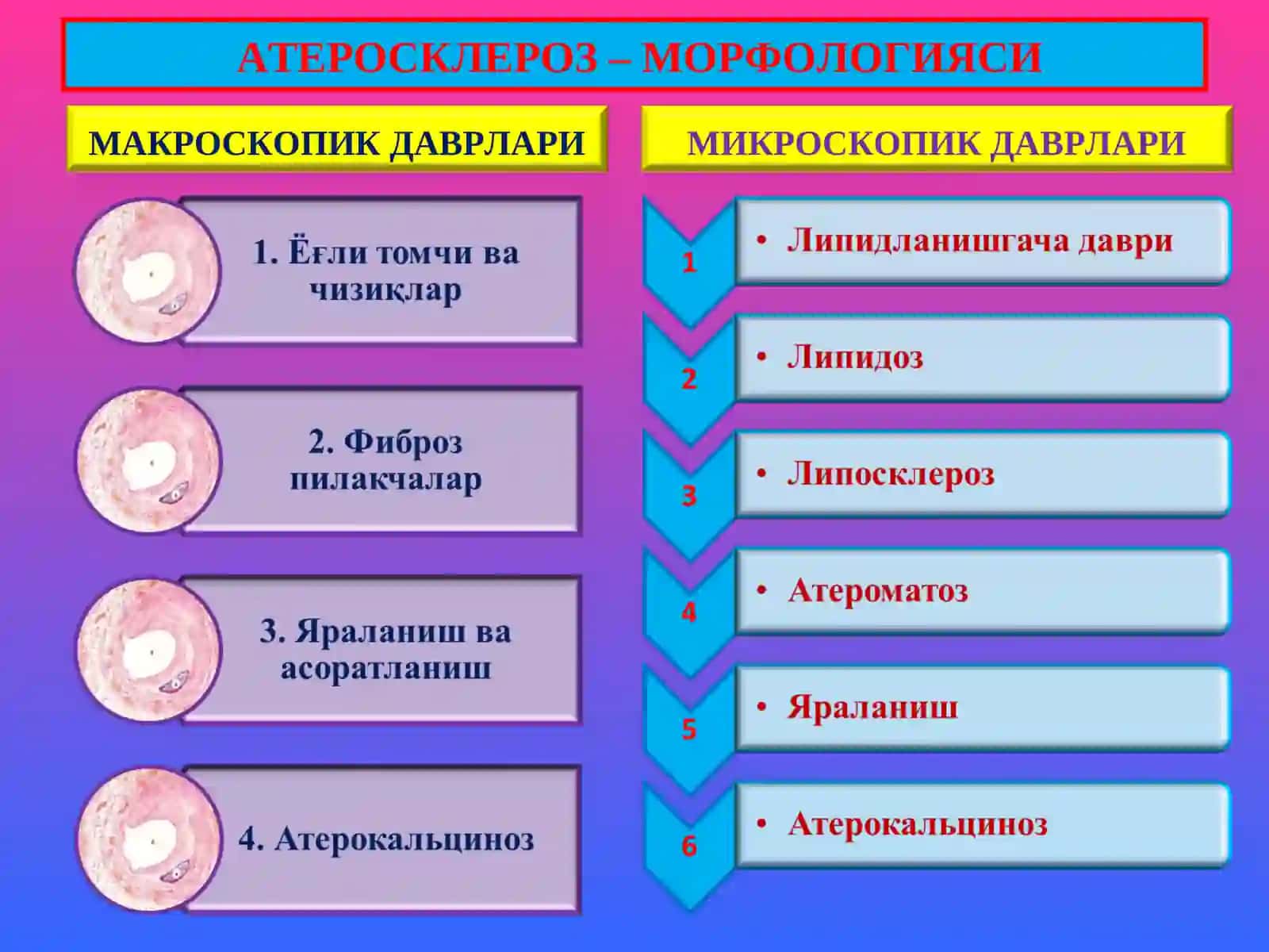 ТОМИР КАСАЛЛИКЛАРИ -АТЕРОСКЛЕРОЗ 4
