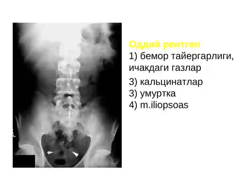 СОНОГРАФИЯ (бирламчи) 4