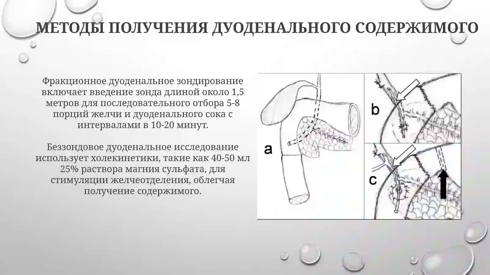 Интерпретация дуоденального сока 4