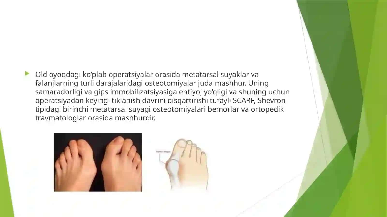 Oyoq suyaklari operatsiyalari. 4