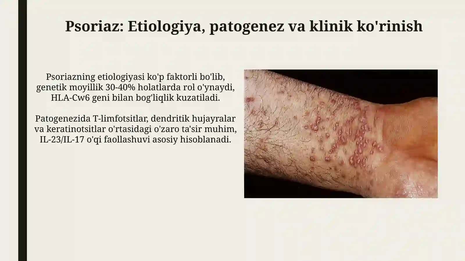 Papulyozdermatozlar va keng tarqalgan tur 4