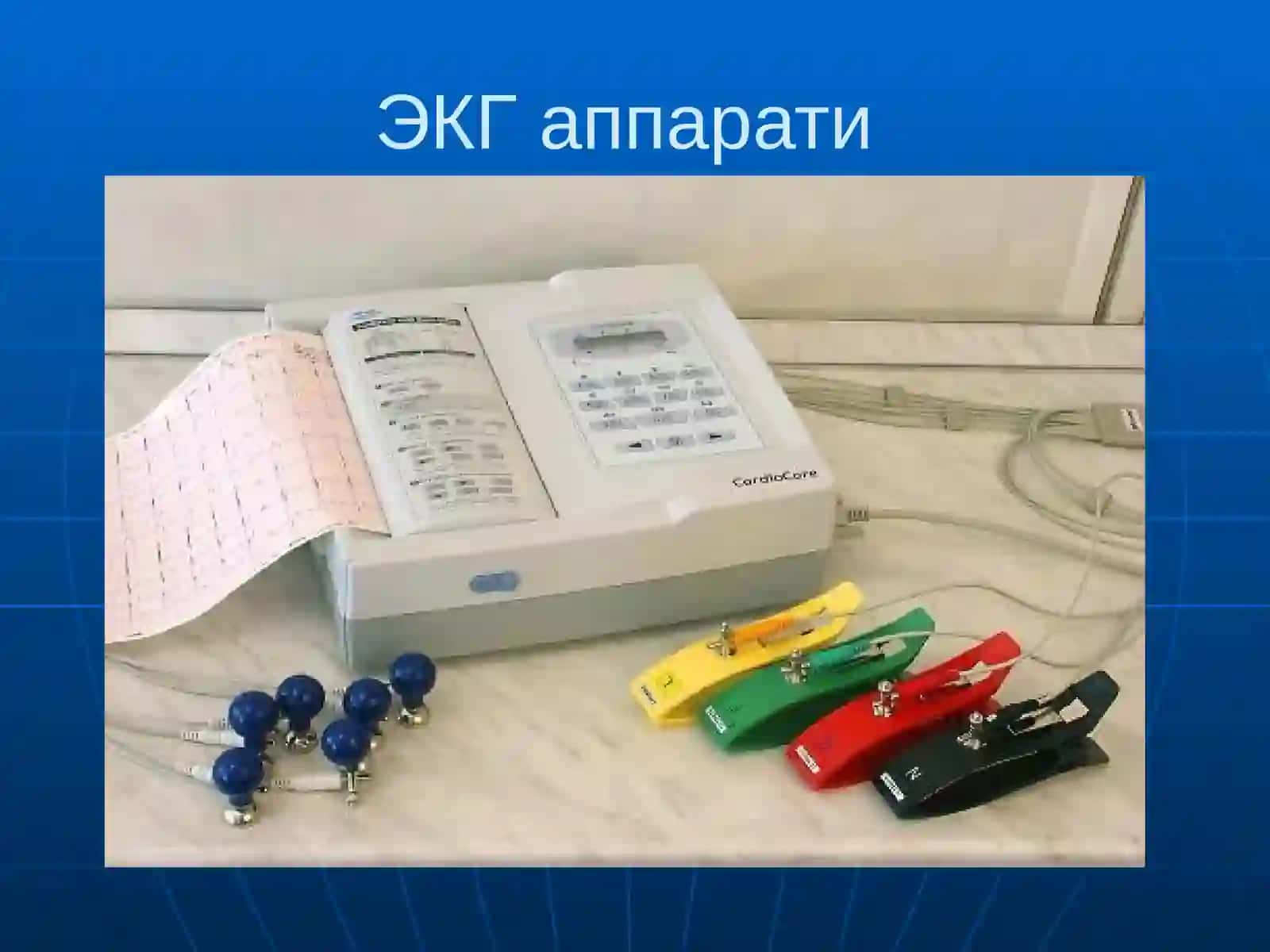 EKG va ExoKG haqida tushuncha 4