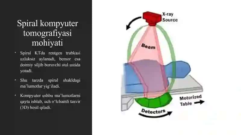 SPIRAL KOMPYUTER TOMOGRAFIYASI (SKT) 4