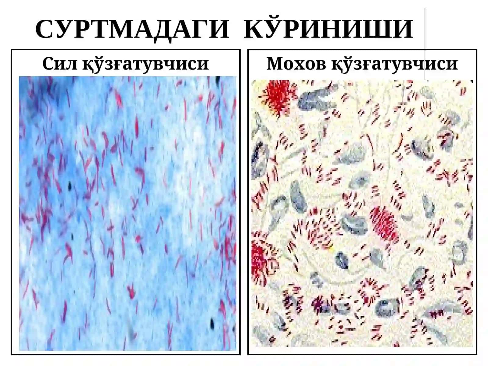 МИКОБАКТЕРИЯЛАР: СИЛ ВА МОХОВ 4