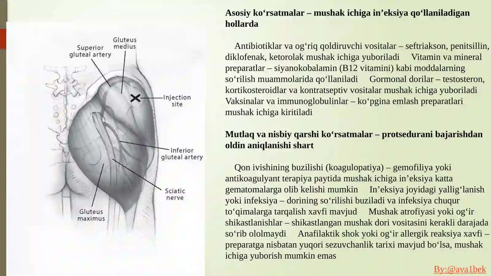 Mushaklar orasiga in’ektsiya qilish 4