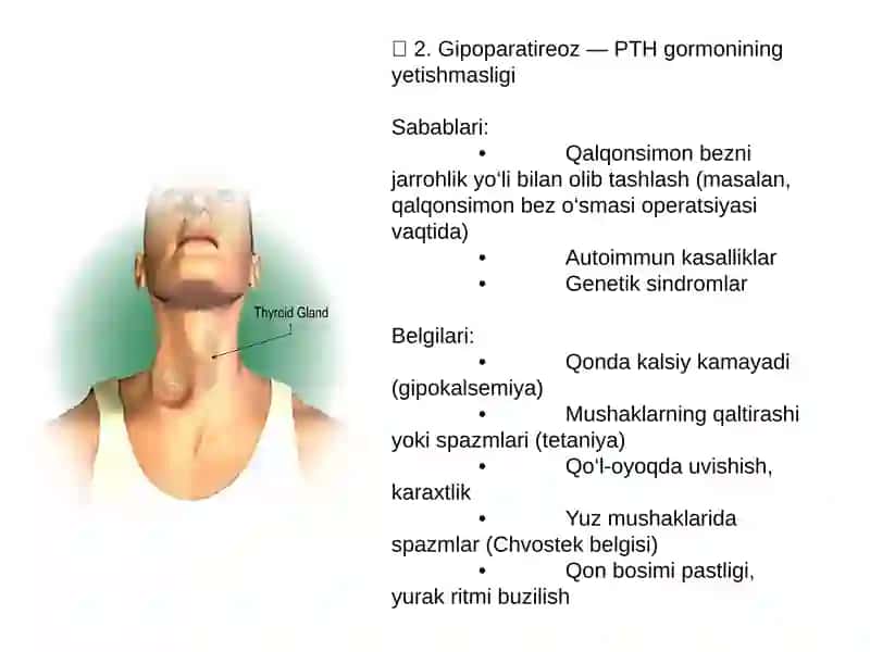 Qalqonoldi bezi kasalliklari .Gipo va giperparatireozlar 4