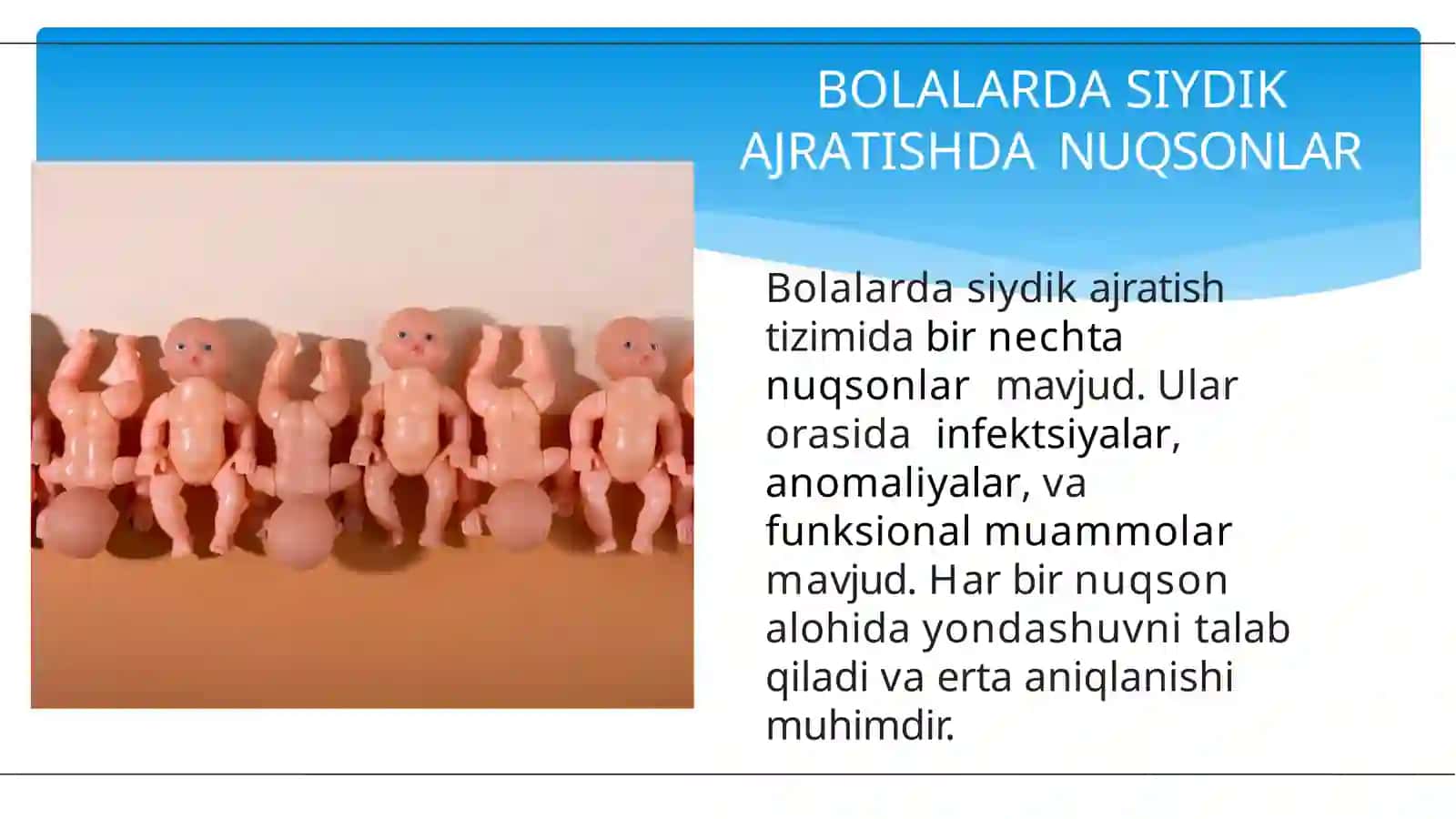 Bolalarda siydik ajratish  tizimi nuqsonlari 4