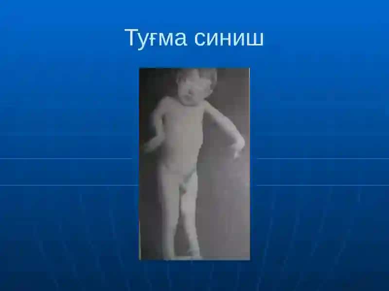 Суякларнингсинишивачикиши 4