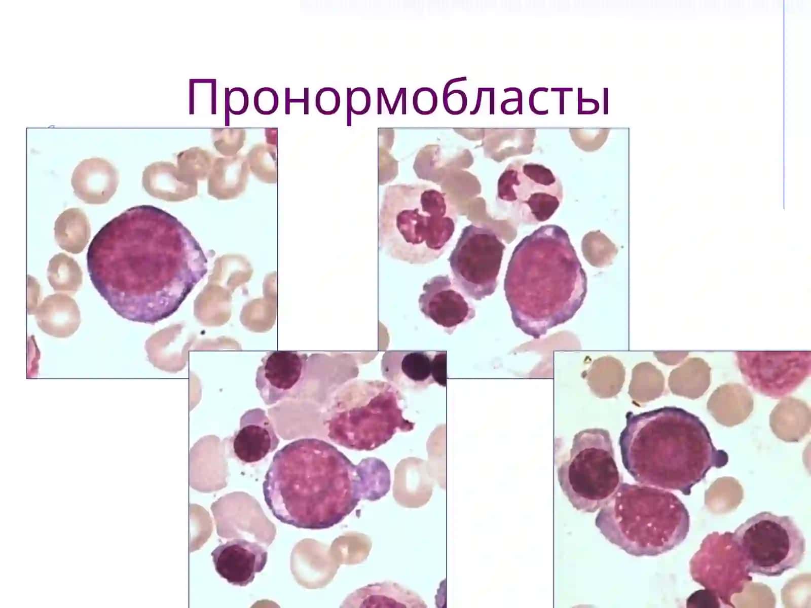 ERITROPOEZ XUJAYRALARINING MORFOLOGIYASI 4